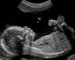扬州助孕中介生男孩-如何从怀孕症状中判断