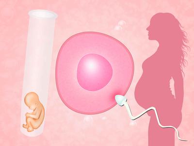 湛江单身合法助孕：哪种类型的身体更适合进
