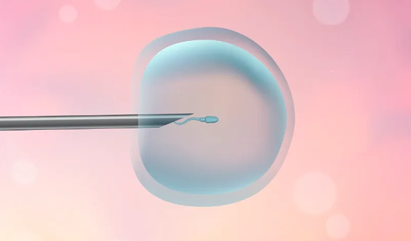 宁波试管助孕联系方式-解释男性试管婴儿测