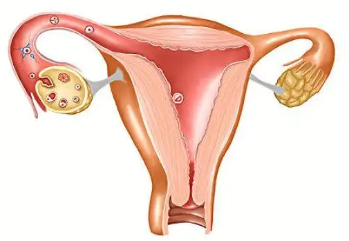 无锡试管婴儿助孕机构：卵巢功能不好也能做